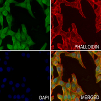 3 - Anti-TCL-1A Antibody AP60856