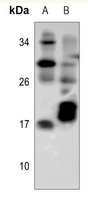 1 - Anti-TCL-1A Antibody AP60856