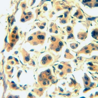 19 - Anti-CD126 Antibody AP60858