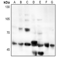 1 - Anti-CD126 Antibody AP60858