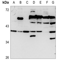 1 - Anti-CD129 Antibody AP60860