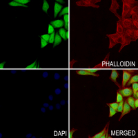 3 - Anti-ZNF307 Antibody AP60862