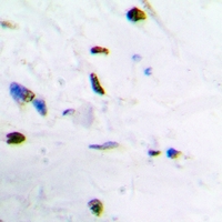 19 - Anti-ZNF307 Antibody AP60862