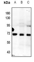 1 - Anti-ZNF307 Antibody AP60862