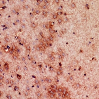 19 - Anti-GDI2 Antibody AP60863