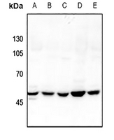 1 - Anti-GDI2 Antibody AP60863