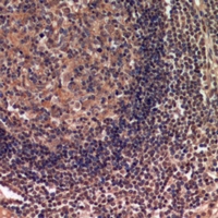 19 - Anti-IDH3 alpha Antibody AP60864