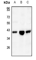 1 - Anti-IDH3 alpha Antibody AP60864