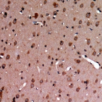 19 - Anti-MERTK/TYRO3 (Phospho-Y749/681) Antibody AP60865