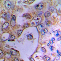 19 - Anti-UCP2 Antibody AP60867