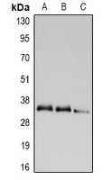 1 - Anti-UCP2 Antibody AP60867