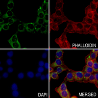 3 - Anti-GABRB2 Antibody AP60868