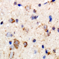 19 - Anti-GABRB2 Antibody AP60868