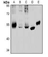1 - Anti-GABRB2 Antibody AP60868