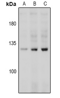 1 - Anti-CD144 (Phospho-Y731) Antibody AP60869