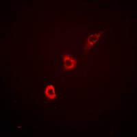 3 - Anti-ITPKA Antibody AP60870