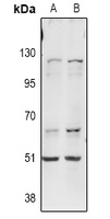 1 - Anti-ITPKA Antibody AP60870