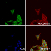 3 - Anti-BUB1B Antibody [KO/KD Validated] AP60871
