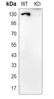 0 - Anti-BUB1B Antibody [KO/KD Validated] AP60871