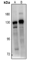 1 - Anti-BUB1B Antibody [KO/KD Validated] AP60871