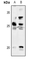 1 - Anti-Thymidine Kinase 1 Antibody AP60873