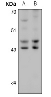 1 - Anti-HSD17B2 Antibody AP60874