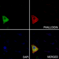 3 - Anti-FR beta Antibody AP60875