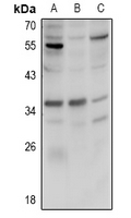 1 - Anti-FR beta Antibody AP60875
