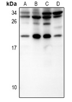 1 - Anti-IL-15 Antibody AP60878