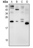 1 - Anti-AVP Antibody AP60880