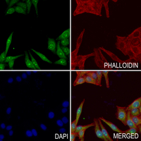3 - Anti-Transglutaminase 3 Antibody AP60884