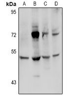 1 - Anti-Transglutaminase 3 Antibody AP60884