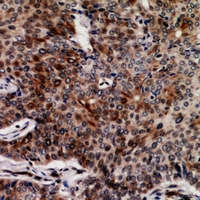 19 - Anti-FASTKD3 Antibody AP60885