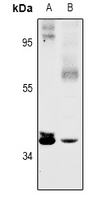 1 - Anti-SFXN4 Antibody AP60886
