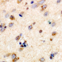 19 - Anti-TRIM59 Antibody AP60887