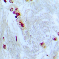 19 - Anti-ZNF287 Antibody AP60890