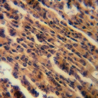 19 - Anti-LPCAT2 Antibody AP60891