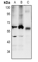 1 - Anti-LPCAT2 Antibody AP60891