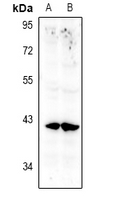 1 - Anti-Annexin A10 Antibody AP60892