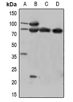 1 - Anti-Beta-catenin (Phospho-Y670) Antibody AP60894