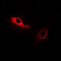 3 - Anti-KSR2 Antibody AP60895