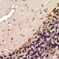 19 - Anti-KSR2 Antibody AP60895