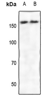 1 - Anti-ROCK2 Antibody AP60897