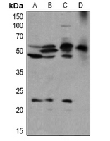 1 - Anti-BLK (Phospho-Y389) Antibody AP60900