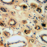 19 - Anti-CEP95 Antibody AP60901