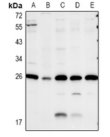 1 - Anti-Caveolin 2 Antibody AP60904