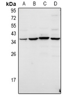 1 - Anti-TWIK3 Antibody AP60905