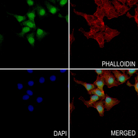 3 - Anti-RNF111 Antibody AP60908