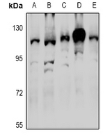 1 - Anti-RNF111 Antibody AP60908