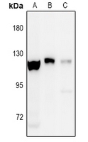 1 - Anti-EPHA8 (Phospho-Y838) Antibody AP60909